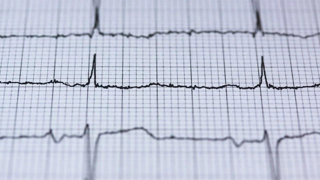 Влияние алкоголя на сердечный ритм: опасные риски при умеренном употреблении