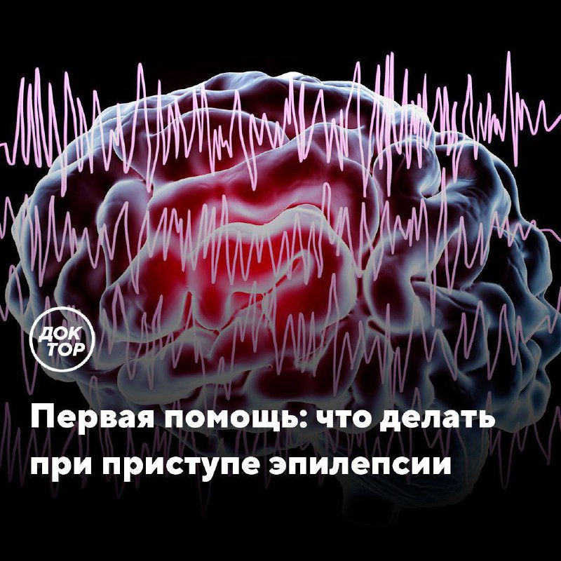 Что делать при приступе эпилепсии: руководство по первой помощи