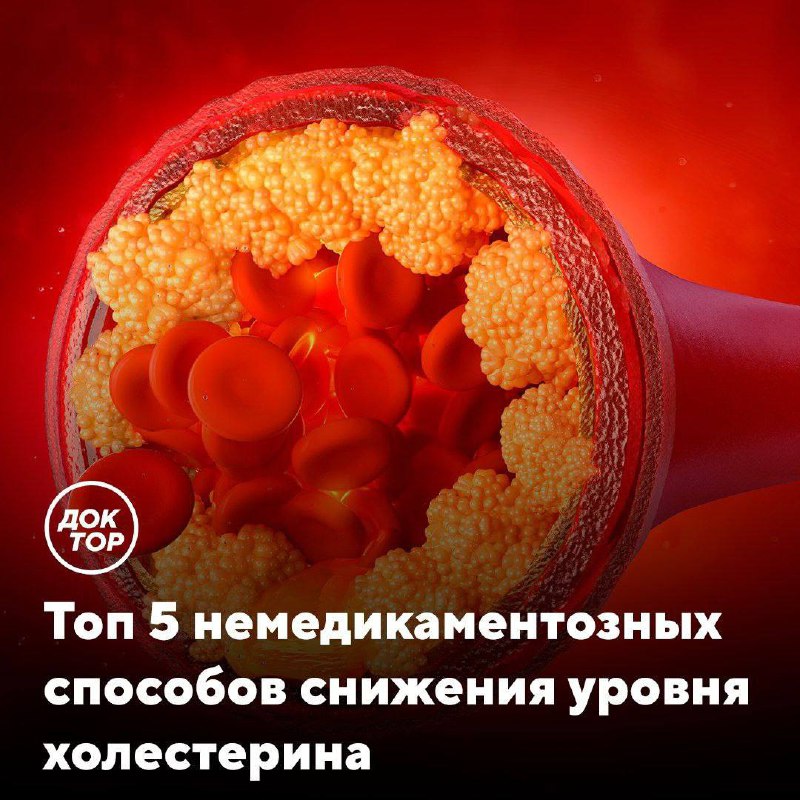 Как снизить уровень холестерина без медикаментов Как снизить уровень холестерина без медикаментов