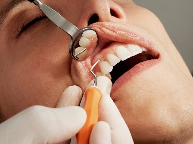 Средиземноморская диета помогает бороться с кариесом и воспалением десен
