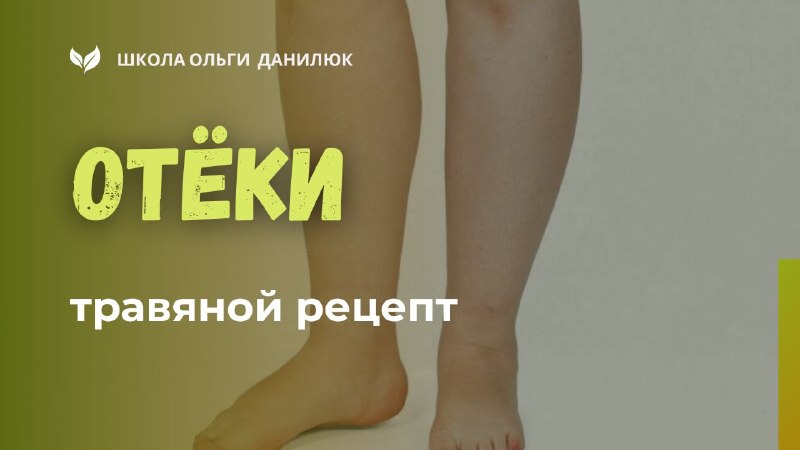 Натуральное средство для устранения задержки жидкости в организме