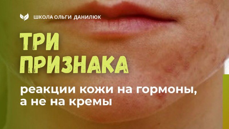 Три признака гормональной реакции кожи