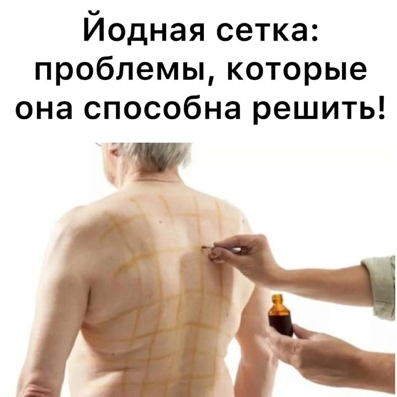 Проблемы, которые решает йодная сетка