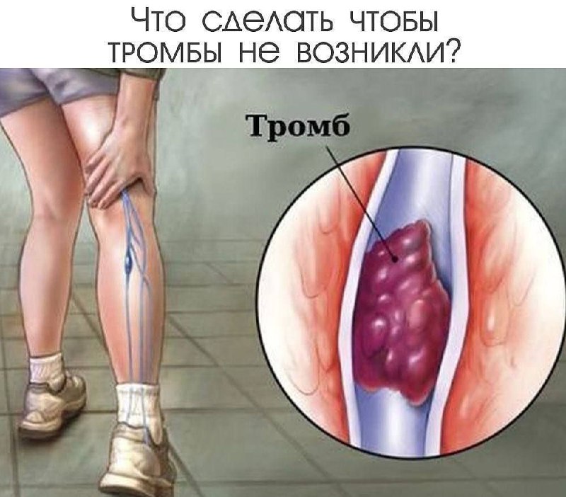 Как предотвратить образование тромбов: советы по питанию и гидратации