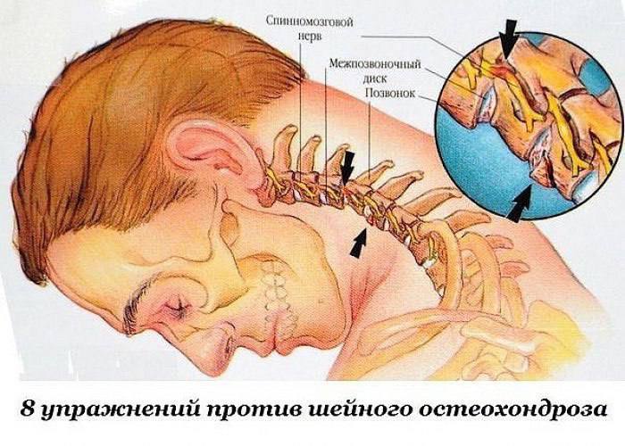 Восемь эффективных упражнений при шейном остеохондрозе