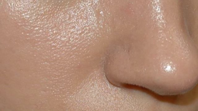 Жирная кожа: почему не стоит очищать до скрипа