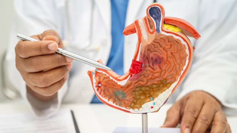 Язва не от нервов: настоящие причины и роль Helicobacter pylori Язва не от нервов: настоящие причины и роль Helicobacter pylori